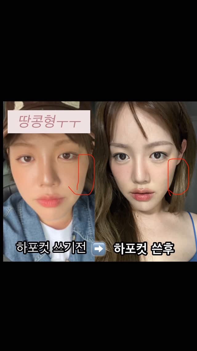 jiwwwwwooooo 게시물 이미지: 효과쩔더라 진짜..
전용젤+최저가+선착순구매인증 이벤트까지🎉
어디서도 볼수없는...