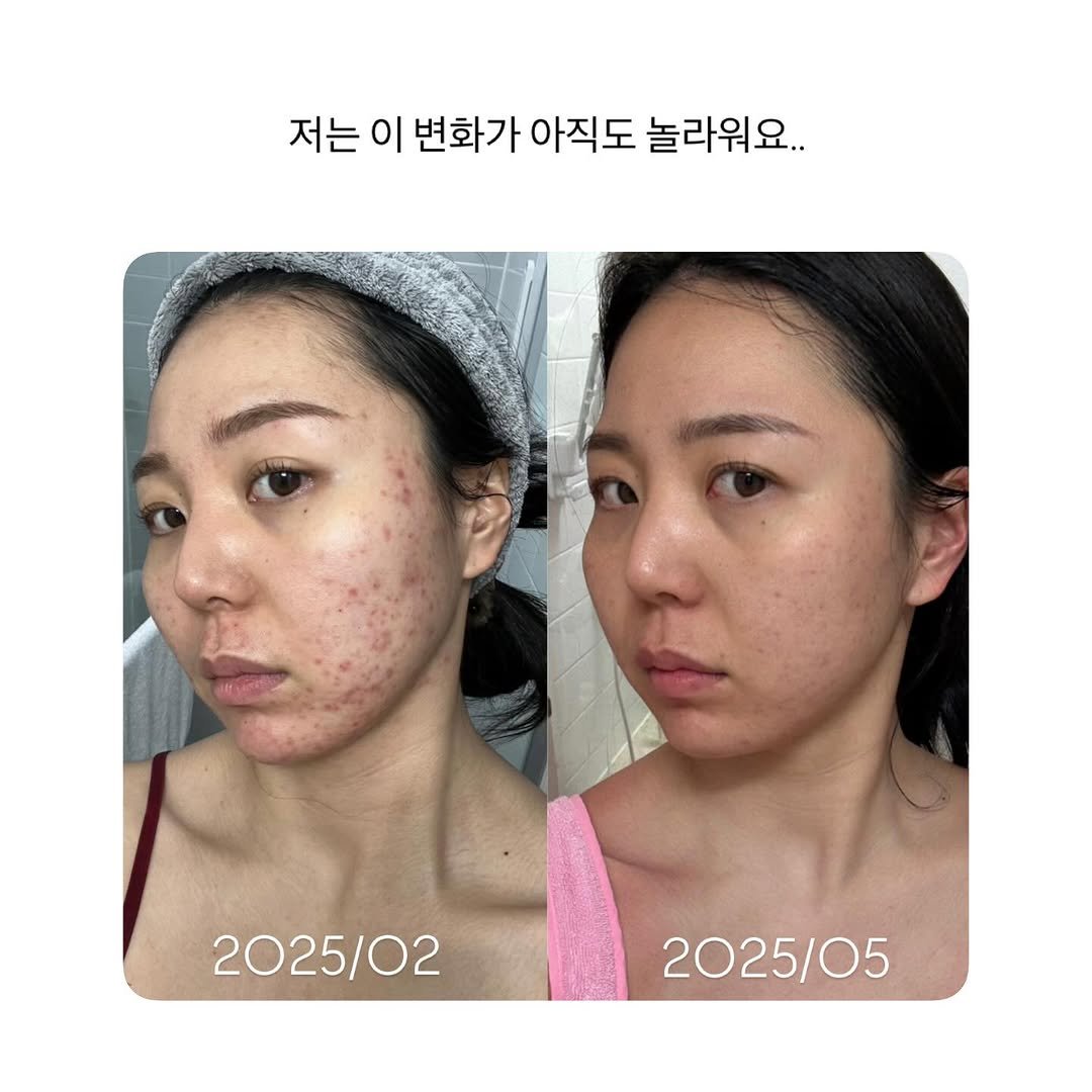 Photo by 모리녀 | 모든 걸 리뷰하는 여자 on August 11, 2025. May be an image of 2 people and text that says '저는이변화가아직도놀라워요.. 저는 이 변화가 아직도 놀라워요.. 2025/02 2025/022025/05 2025/05'.